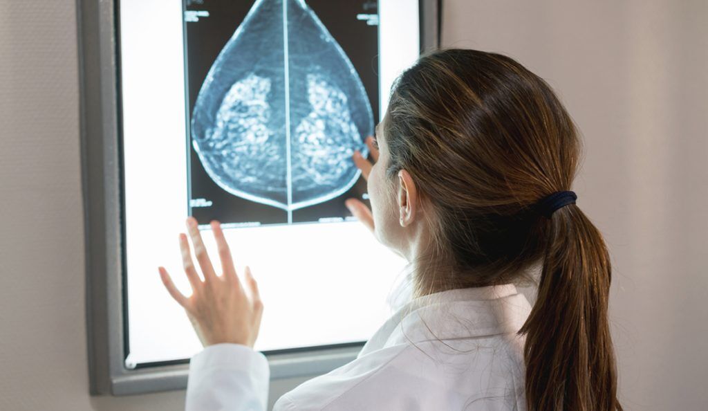 A doctor looks at a patient's mammogram