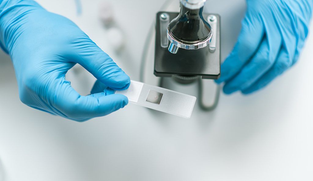 an overhead shot of a person's hands wearing blue gloves