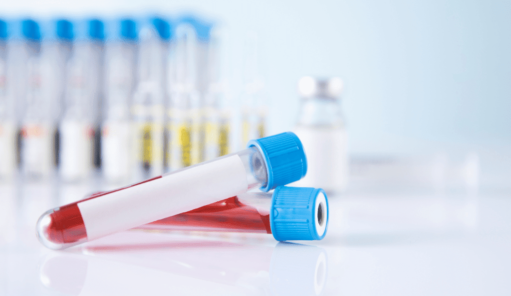 a photo of two vials used to take blood draws