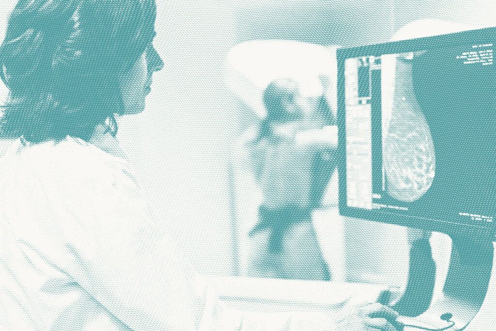 Dense Breast Tissue: What It Means and What to Know