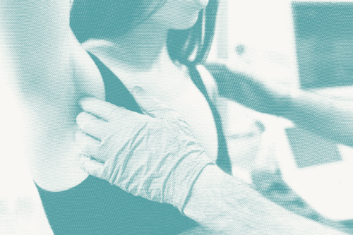 A doctor wears gloves and does a breast exam on a woman, focusing on her lymph nodes under her armpits.